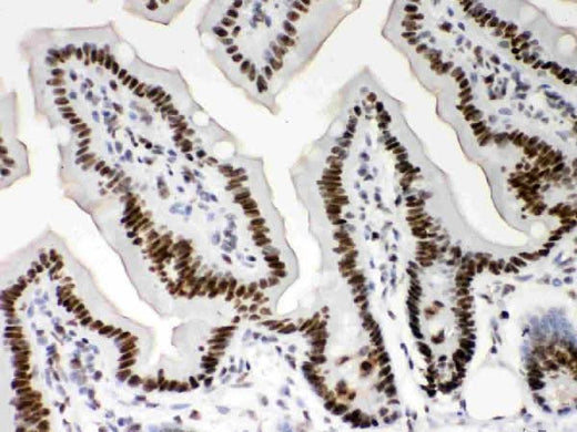 Anti-Nucleophosmin/NPM1 Antibody Picoband® Boster Bio