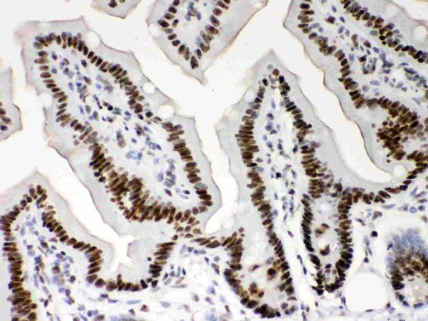 Anti-Nucleophosmin/NPM1 Antibody Picoband® Boster Bio