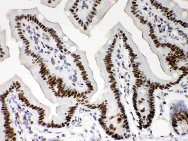 Anti-Nucleophosmin/NPM1 Antibody Picoband® Boster Bio