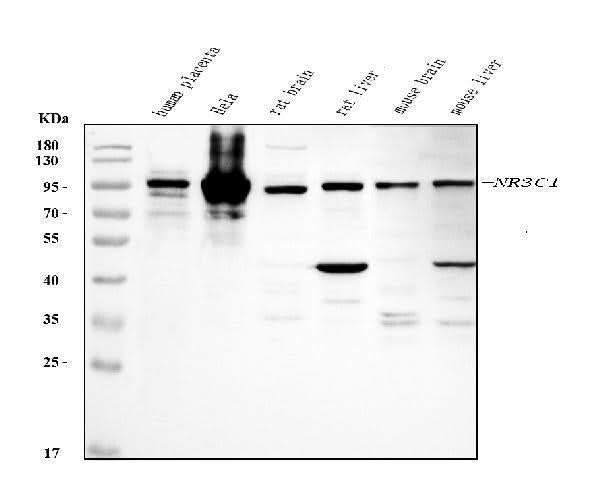 Anti-Glucocorticoid Receptor/NR3C1 Antibody Picoband® Boster Bio