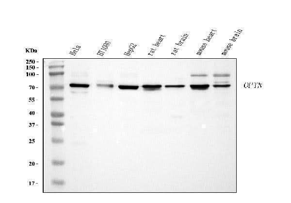 Anti-Optineurin/OPTN Antibody Picoband® Boster Bio
