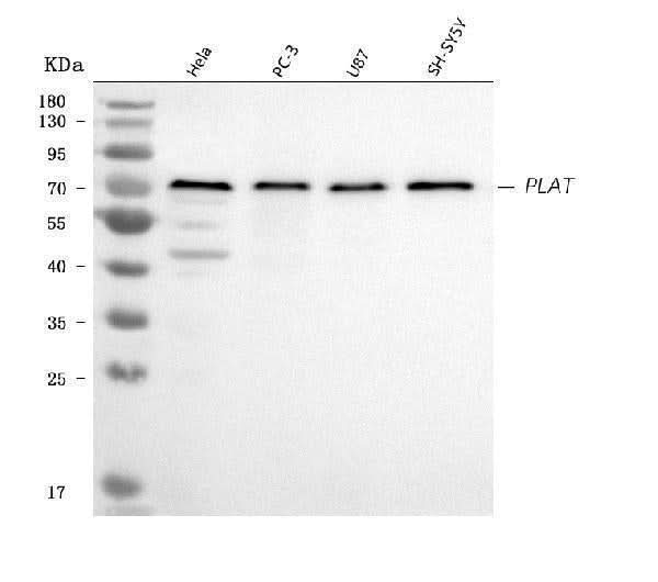 Anti-TPA Tissue Plasminogen Activator/PLAT Antibody Picoband® Boster Bio