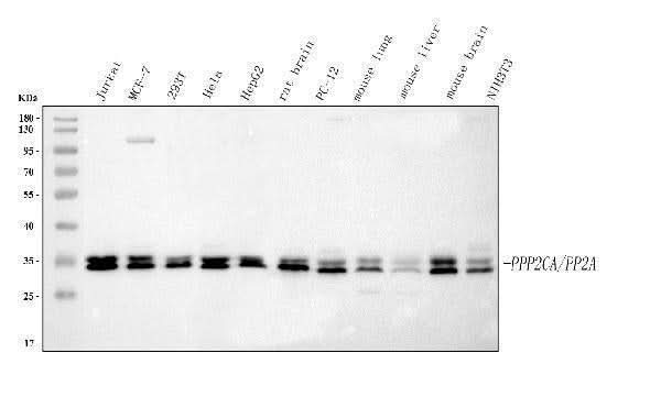 Anti-PP2A-alpha/PPP2CA Antibody Picoband® Boster Bio