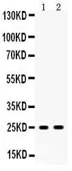 Anti-PSCA Antibody Picoband® Boster Bio