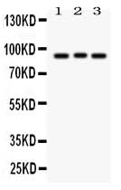 Anti-Semaphorin 3A/SEMA3A Antibody Picoband® Boster Bio