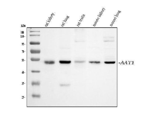 Anti-alpha 1 Antitrypsin/SERPINA1 Antibody Picoband® Boster Bio