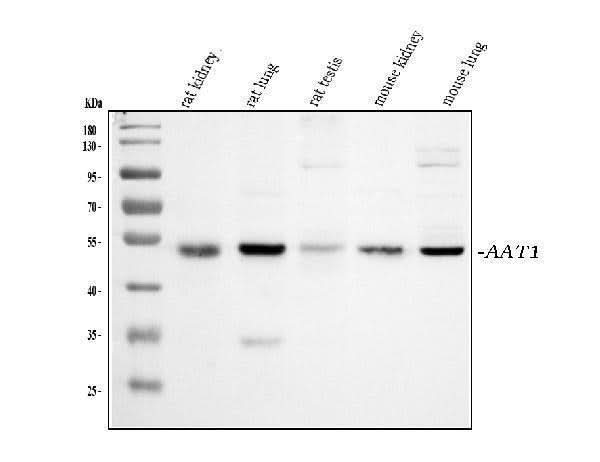 Anti-alpha 1 Antitrypsin/SERPINA1 Antibody Picoband® Boster Bio
