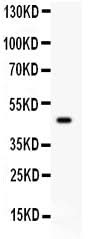Anti-SerpinB2 Antibody Picoband® Boster Bio