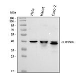 Anti-MASPIN/SERPINB5 Antibody Picoband® Boster Bio