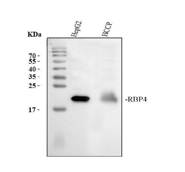 Anti-RBP4 Antibody Picoband® Boster Bio