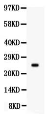 Anti-Prolactin/PRL Antibody Picoband® Boster Bio