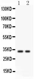 Anti-SFRP2 Antibody Picoband® Boster Bio