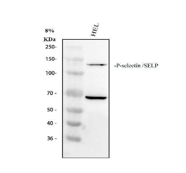 Anti-CD62P/SELP Antibody Picoband® Boster Bio