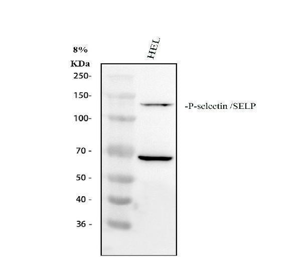 Anti-CD62P/SELP Antibody Picoband® Boster Bio