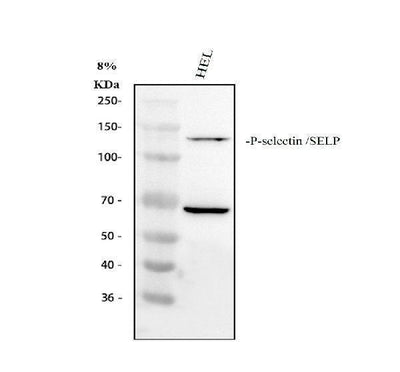 Anti-CD62P/SELP Antibody Picoband® Boster Bio