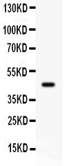 Anti-beta 2 Adrenergic Receptor/ADRB2 Antibody Picoband® Boster Bio