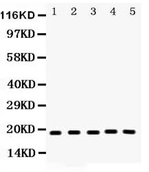 Anti-Caspase-2/CASP2 Antibody Picoband® Boster Bio