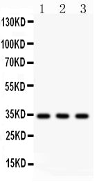 Anti-Caspase-7/CASP7 Antibody Picoband® Boster Bio
