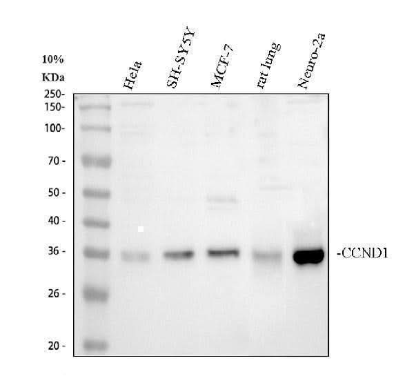 Anti-Cyclin D1/CCND1 Antibody Picoband® Boster Bio