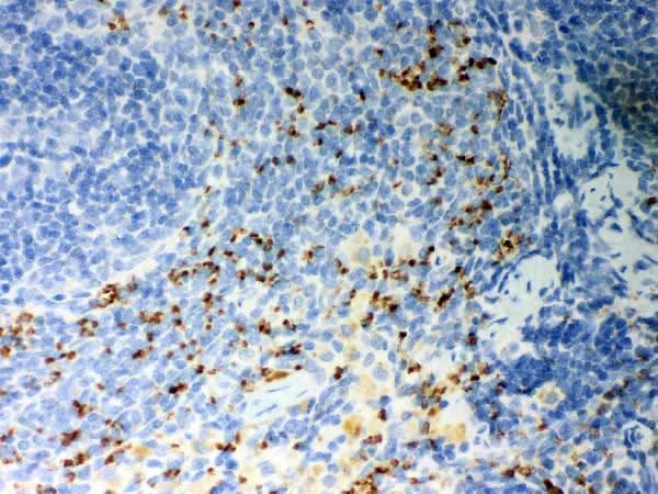 Anti-CD36 Antibody Picoband® Boster Bio