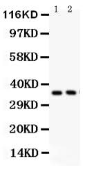 Anti-FRZB Antibody Picoband® Boster Bio