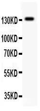 Anti-NMDAR2C/GRIN2C Antibody Picoband® Boster Bio