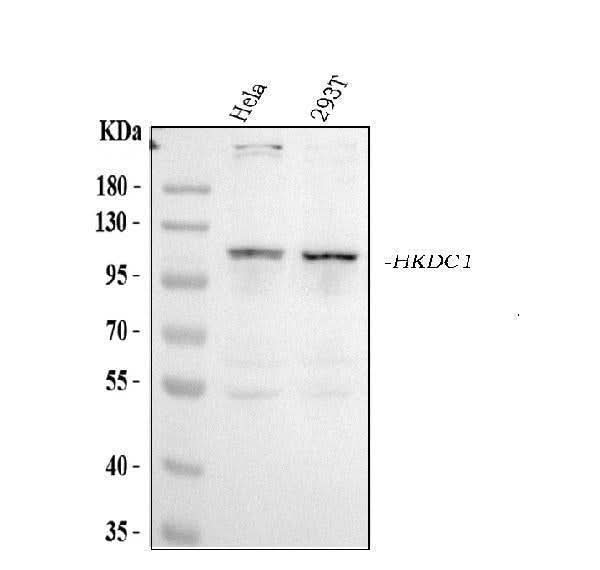 Anti-HKDC1 Antibody Picoband® Boster Bio