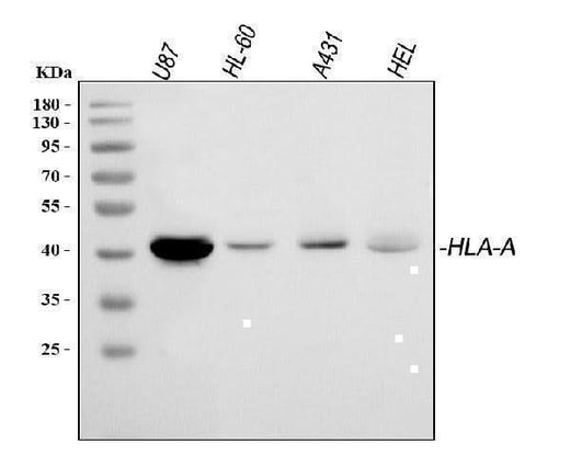 Anti-HLA A/HLA-A Antibody Picoband® Boster Bio