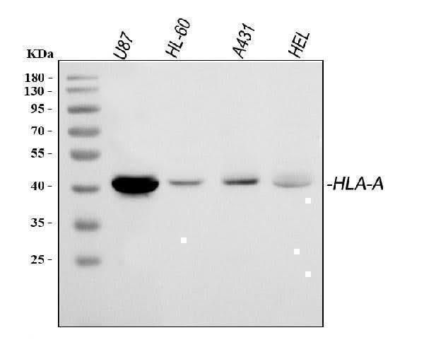 Anti-HLA A/HLA-A Antibody Picoband® Boster Bio