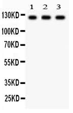 Anti-Phospholipase D1/PLD1 Antibody Picoband® Boster Bio