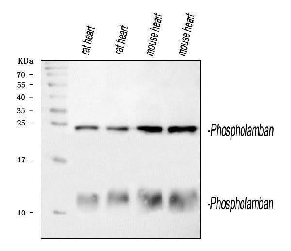 Anti-Phospholamban/PLN Antibody Picoband® Boster Bio