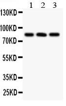 Anti-Calcineurin A/PPP3CA Antibody Picoband® Boster Bio