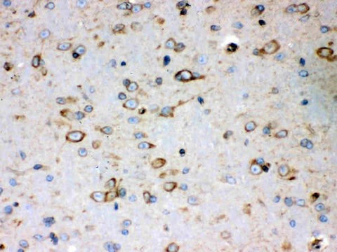 Anti-Peroxiredoxin 4/PRDX4 Antibody Picoband® Boster Bio
