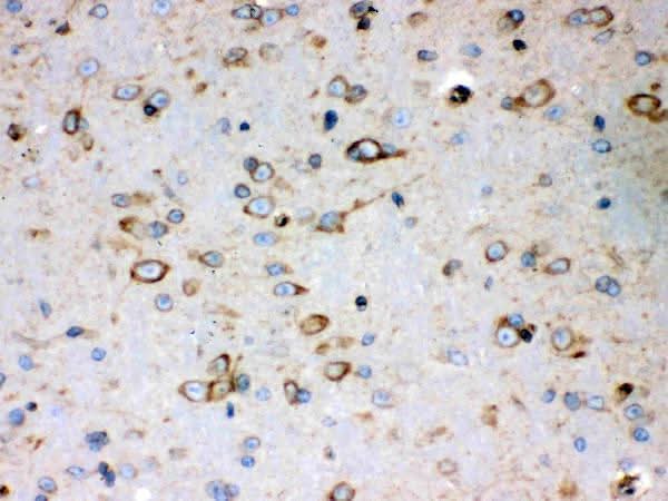 Anti-Peroxiredoxin 4/PRDX4 Antibody Picoband® Boster Bio