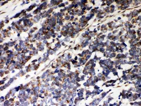 Anti-Peroxiredoxin 5/PRDX5 Antibody Picoband® Boster Bio