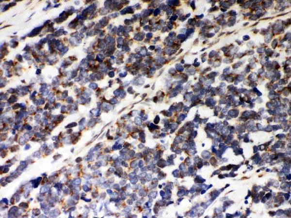 Anti-Peroxiredoxin 5/PRDX5 Antibody Picoband® Boster Bio