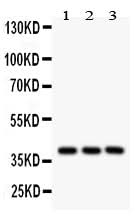Anti-Prostaglandin E Receptor EP2/PTGER2 Antibody Picoband® Boster Bio
