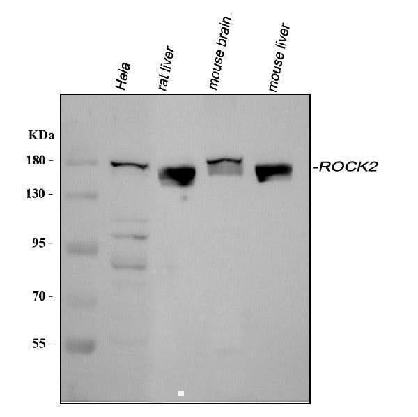 Anti-ROCK2 Antibody Picoband® Boster Bio