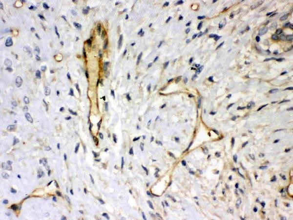 Anti-Syndecan 4/SDC4 Antibody Picoband® Boster Bio