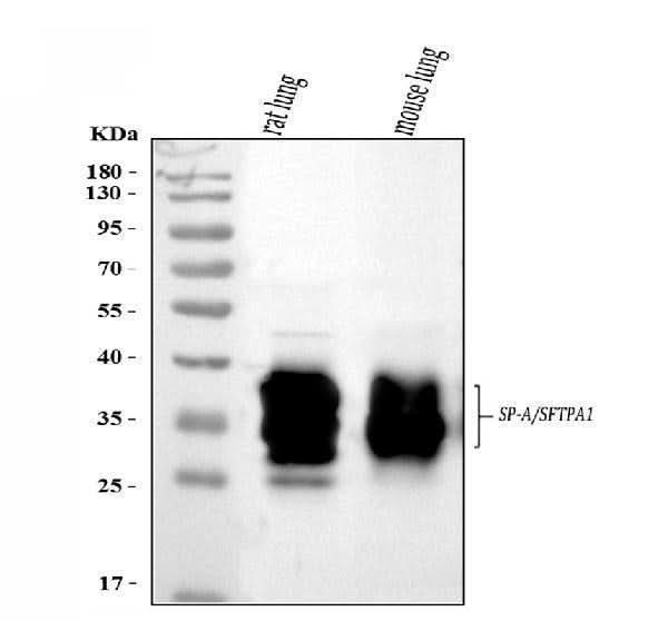 Anti-SFTPA1/2 Antibody Picoband® Boster Bio