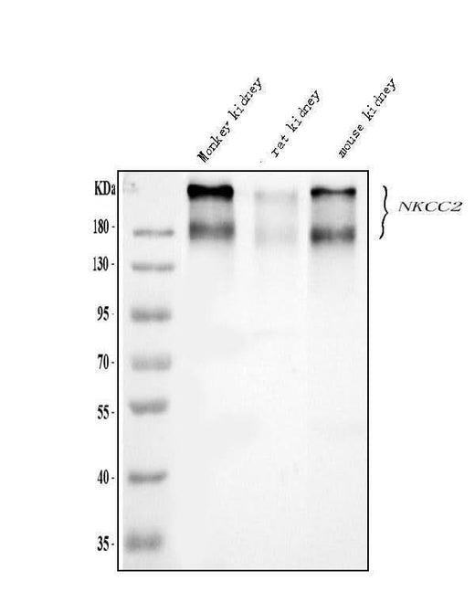 Anti-SLC12A1 Antibody Picoband® Boster Bio