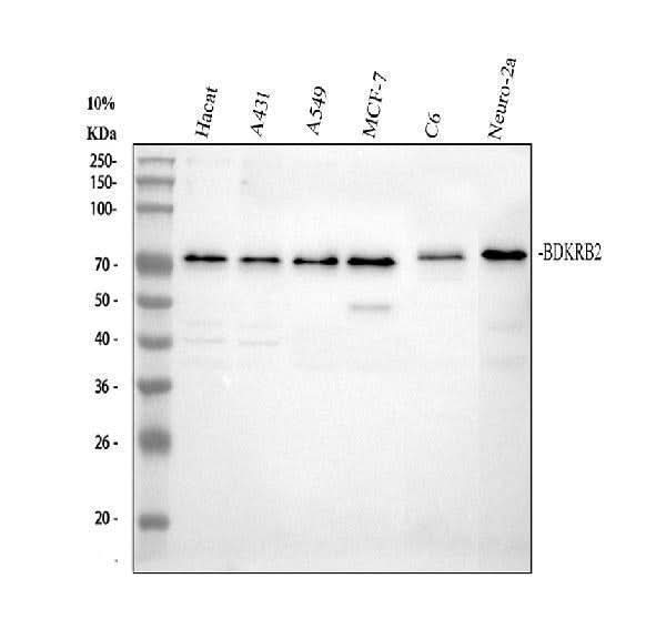 Anti-BDKRB2 Antibody Picoband® Boster Bio