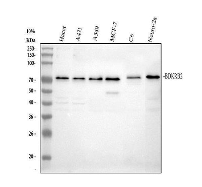 Anti-BDKRB2 Antibody Picoband® Boster Bio