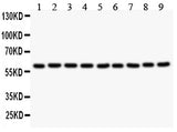Anti-Smad4 Antibody Picoband® Boster Bio