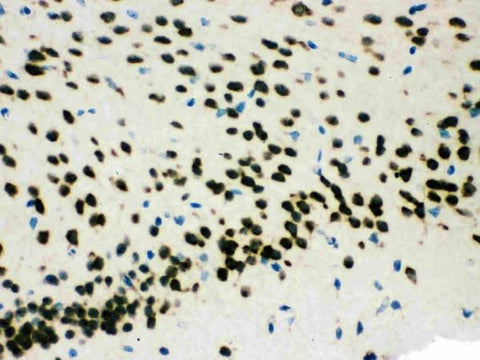 Anti-SMN1/2 Antibody Picoband® Boster Bio
