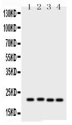 Anti-SOCS2 Antibody Picoband® Boster Bio