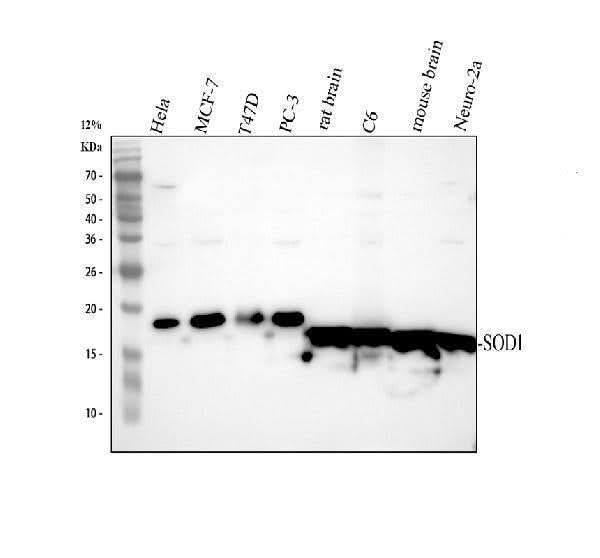 Anti-Superoxide Dismutase 1/SOD1 Antibody Picoband® Boster Bio