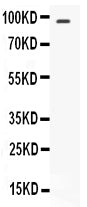 Anti-STAT6 Antibody Picoband® Boster Bio