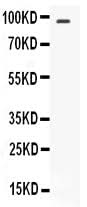 Anti-STAT6 Antibody Picoband® Boster Bio