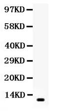 Anti-Resistin/RETN Antibody Picoband® Boster Bio